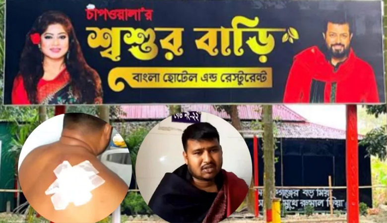 ওমর সানীর রেস্তোরাঁয় কাস্টমারকে কুপিয়ে জখম