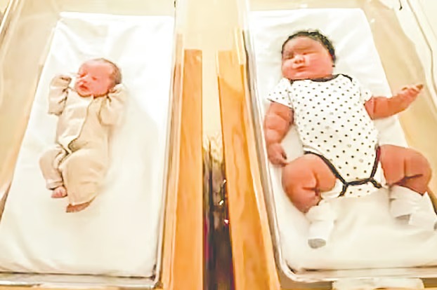 নবজাতকের ওজন ছয় কেজি, চিকিৎসকেরা হতবাক