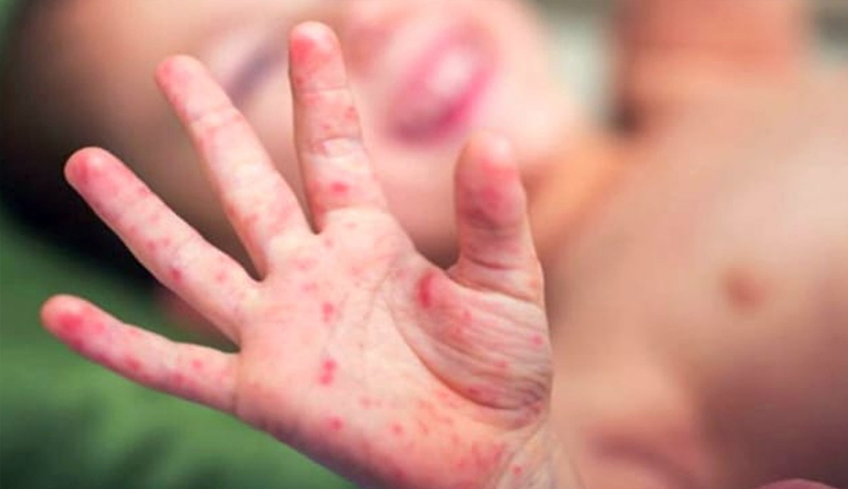 দরকার সর্বাত্মক কর্মপরিকল্পনা ও কঠোর ব্যবস্থা