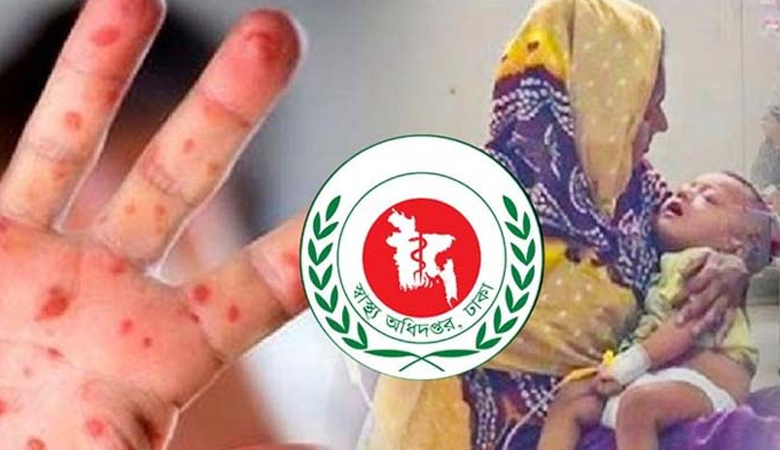 হাম ও হামের উপসর্গ নিয়ে আরো ৭ জনের মৃত্যু
