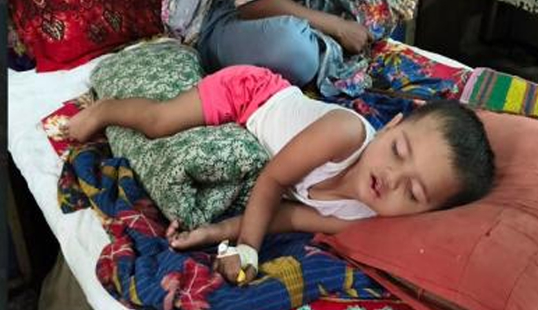 হাম ও হামের উপসর্গ নিয়ে প্রাণ গেল আরো ১৩ শিশুর