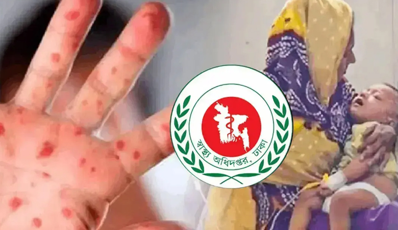 হামের উপসর্গে আরো ৭ শিশুর মৃত্যু