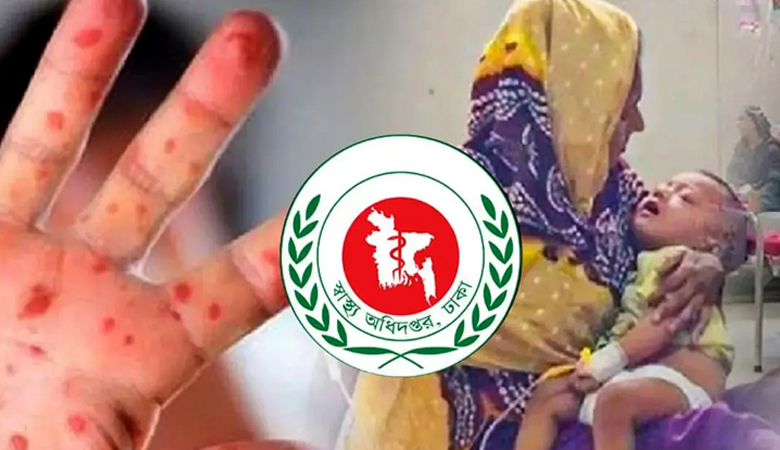 হামের উপসর্গ নিয়ে আরো ৫ শিশুর মৃত্যু