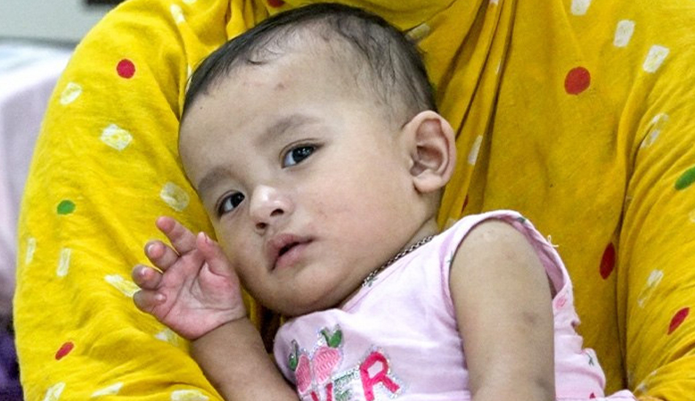 হামের উপসর্গে ৪ শিশুর মৃত্যু