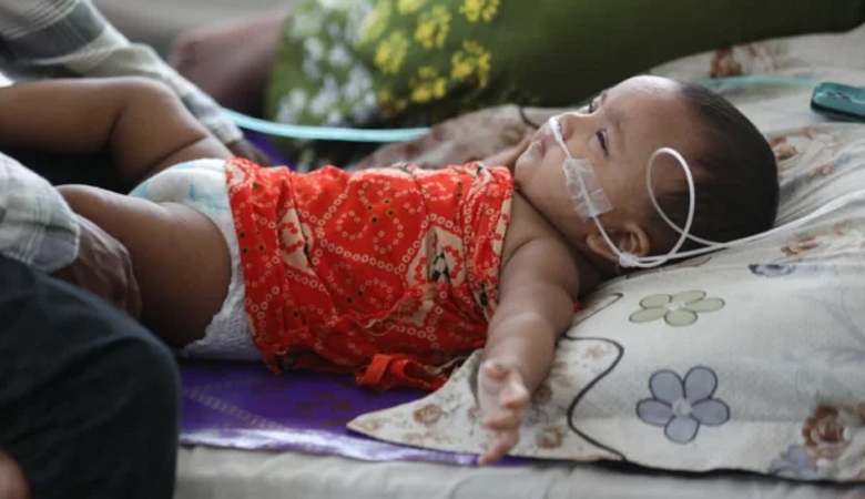 হামের উপসর্গ নিয়ে আরো ৫ শিশুর মৃত্যু
