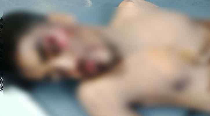 শাহ আমানত সেতু এলাকায় গণপিটুনিতে আশঙ্কাজনক অবস্থায় যুবক
