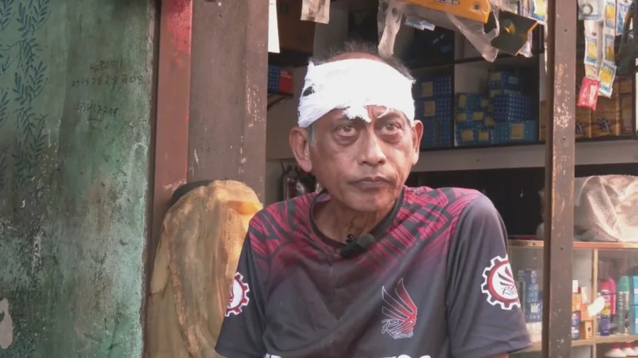 যশোরে বাসার সামনে অভিনেতা সমু চৌধুরীর মাথা ফাটালেন দুই ব্যক্তি